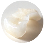 ジルコニアセラミック レイヤード